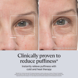 Therabody TheraFace Depuffing Wand – Cold and Heat Skincare Treatment to depuff and Glow (Indigo)